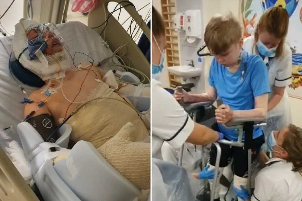 Teen suffers 'worst burns' doctors have ever seen after making dangerous mistake trying to put out flames | The Sun